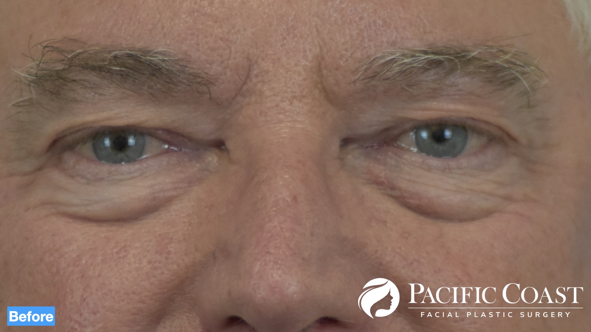 best facial plastic surgeon orange county